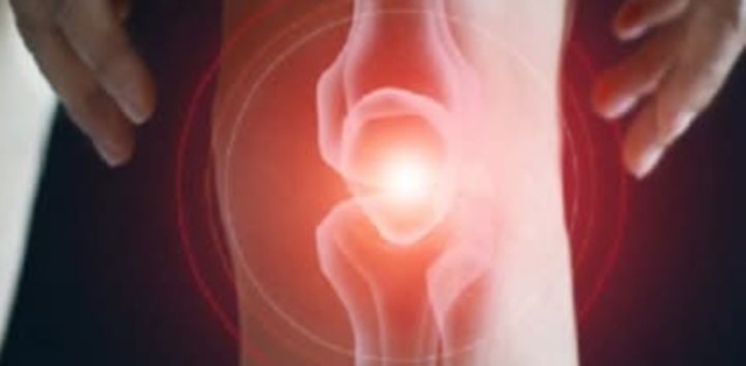 Garlic & Cloves: The Natural Remedy for Varicose Veins and Circulation