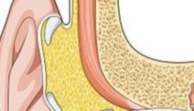 Garlic for Ear Health: Natural Relief and Protection