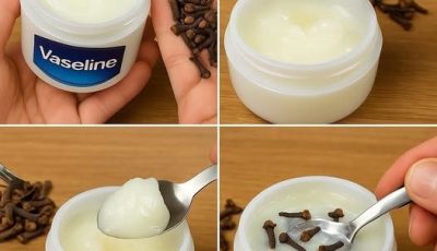 Cloves and Vaseline: A Skincare Hack You Should Try