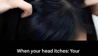 Itchy scalp? Here are the main causes.