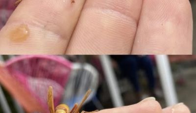 This Is What You Absolutely Should Do When a Wasp Stings You – A Calm, Clear Guide for the Afraid (and Everyone Else)