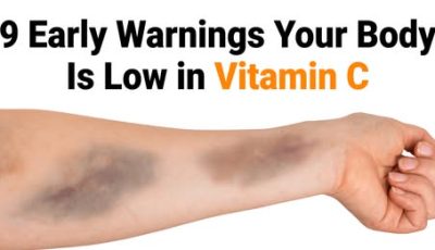 Your Body’s Silent SOS: 9 Early Warning Signs of Vitamin C Deficiency