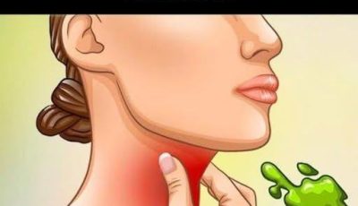 The Real Causes of Constant Phlegm and Mucus in Throat and How to Get Rid of It