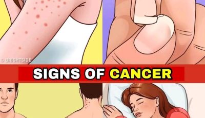 12 warning signs of the presence of cancer cells in your body