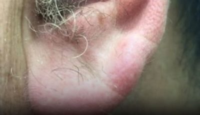 What Your Ear Hair Reveals About Your Health (It’s Not Just About Aging)