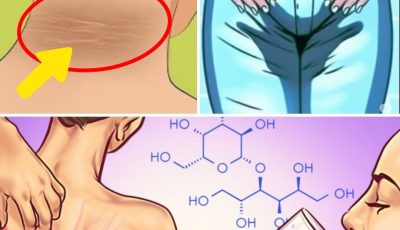 8 Silent Signals Your Body Is Getting Too Much Sugar