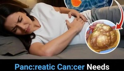 Pan.creatic can.cer: 10 early warning signs you should never ignore