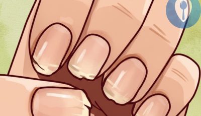 Weak or Brittle Nails: What Your Body Is Trying to Tell You