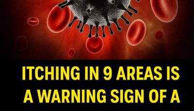 Itching in 9 Areas: A Warning Sign of Malignant Tumors, Number 7 Is the Most Common