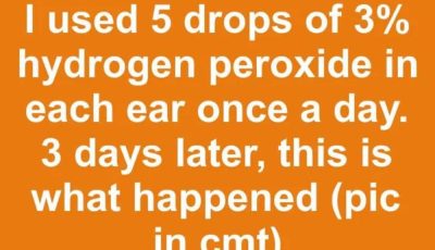 I used 5 drops of 3% hydrogen peroxide in each ear once a day.