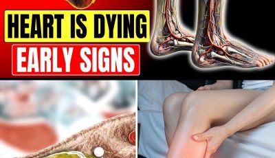10 Warning Signs of Blocked Heart Arteries In Legs and Feet (Don’t Ignore These Signals