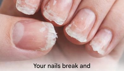 Brittle or fragile nails: what your body is trying to tell you