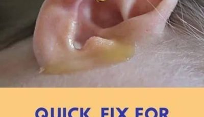 Put 2 drops in your ear and you will hear like before. Recover your hearing.