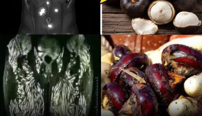 Eating Just One Bite is Already Harmful, But Many Still Eat It Without Worry