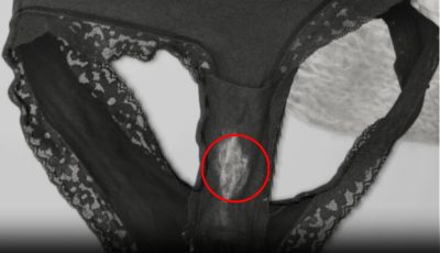 What a “Bleach” Patch on Your Underwear Means