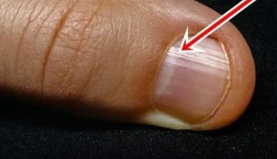 The Best Foods for Stronger Nails After 40