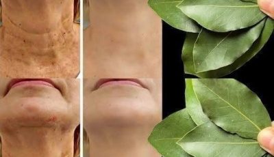What Bay Leaves Actually Do for Skin (The Truth)