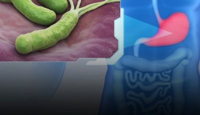 H. pylori Infection — What Science Actually Says About Treatment (Natural Support vs. Medical Necessity)