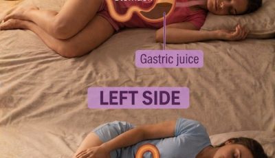 Does Sleeping on Your Right Side Help or Worsen Snoring?