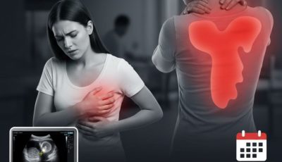10 Breast Cancer Warning Signs You Should Never Ignore: Your Early Detection Guide