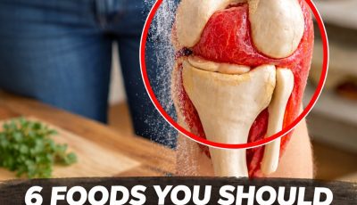 8 Foods Research Suggests Limiting for Joint Pain Relief (And Healthier Alternatives)