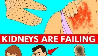 23 Strange Signs Your Kidneys Might Be in Trouble