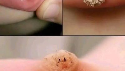These are the first signs of an illness…These are the first signs of an illness…