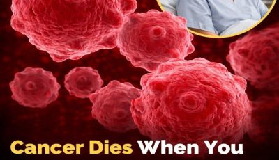 8 Powerful Anti-Cancer Foods You Should Start Including in Your Diet