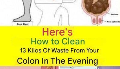 Learn How to Clean 15 Kilograms of Waste from Your Colon in One Night