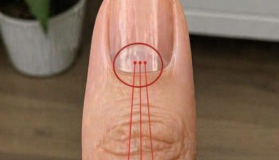 If you have lines on your nails