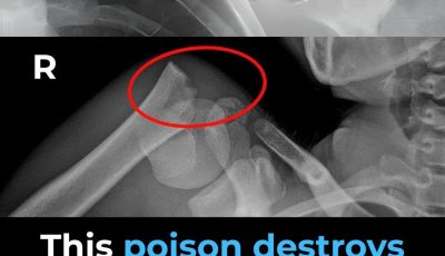 This Drink May Weaken Your Bones From The Inside — But Everyone Drinks It Anyway