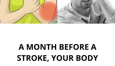 A Month Before a Stroke, Your Body Warns You: 10 Silent Signs Not to Ignore