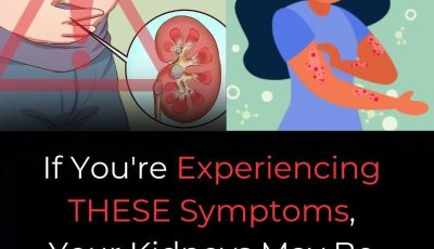 Early Signs of Kid:ney Disease & How to Protect Your Kid:neys
