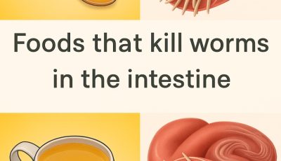 7 Foods That Kill Worms in the Intestine