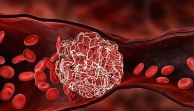 Blood circulation: these are the foods to eat every day to prevent blood clots