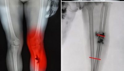 10 Top Secrets to Reclaiming Your Youthful Energy After Sickness That Doctors Dont Always Mention