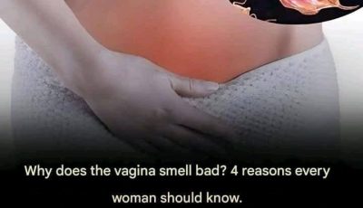 Why does the vagina smell bad? 4 reasons every woman should know