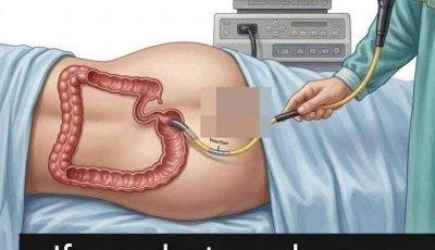 If your doctor orders you to have a colonoscopy, simply tell them that