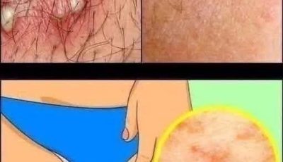 These are the consequences of sleeping with