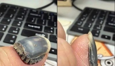 These are the consequences of using too much