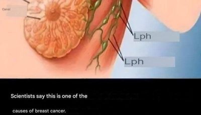 90% of breast cancer cases could be prevented if women followed these 9 rules