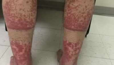 These are the consequences of sleeping with…