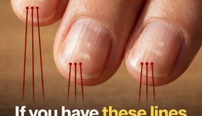 Foods That Support Stronger Nails After 40