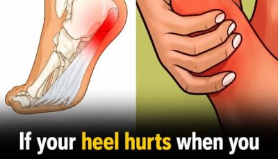 7 effective exercises to reduce heel pain and manage plantar fasciitis naturally