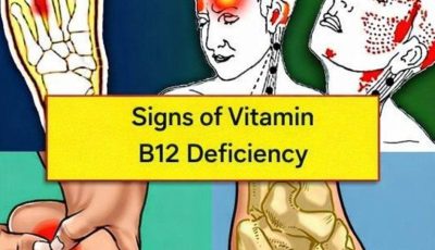 A woman over 40 needs vitamin B12 like air! Here are the warning signs of deficiency.