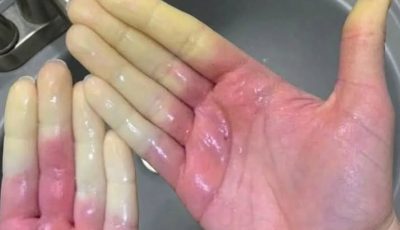 What Really Happens When You Sleep With The Wrong Person