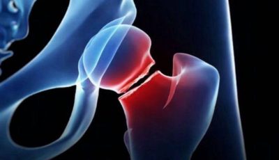 The five drinks that are most harmful to your bones, according to health experts.