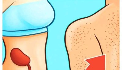 17 signs of kidney trouble you can see—don’t ignore