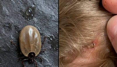 Does anyone know what kind of insect this is? I just found it on my son’s head…