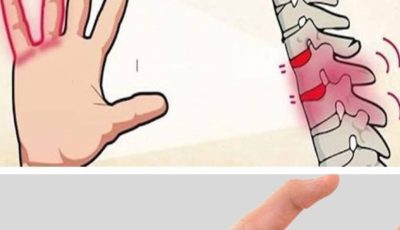 “Wait—Is My Numb Hand Normal… Or Should I Worry?” Let’s Talk About That Tingle